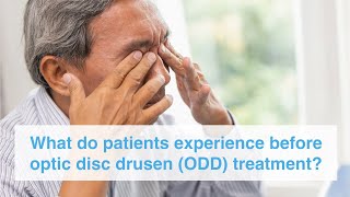 What do patients experience before optic disc drusen ODD treatment [upl. by Nnahoj243]