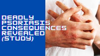 Deadly Psoriasis Consequences Revealed Study [upl. by Ilsa]