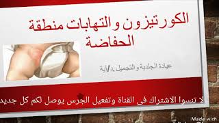 ❌احذرى كريمات شائعة تستخدم لالتهابات منطقة الحفاضة🚼🚼 napkin dermatitis [upl. by Dahraf701]