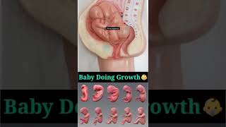 Twins baby growth [upl. by Maloy]