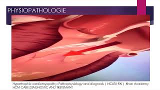 La cardiomyopathie hypertrophique CMH Partie 1 [upl. by Miah]