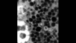 NIDCR Granules in a Salivary Acinar Cell [upl. by Naiditch]