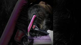 Derma Roller  Microneedling for Hair Regrowth [upl. by Roseanna]