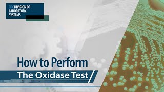 How to Perform the Oxidase Test [upl. by Bond]