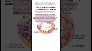 Transfusionassociated graft versus host disease [upl. by Vern674]