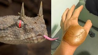 20 Most Painful Snake Bites In The World [upl. by Fidelis87]