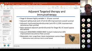 2022 ABSITE Review Surgical Oncology [upl. by Thedric]