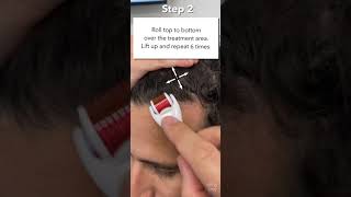 How To Use The StimuRoller Derm Roller  Micro needling for Hair Loss amp Stimulate Hair Growth [upl. by Ycrad]