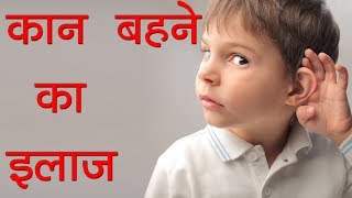 कान बहने का इलाज  Treatment of Otorrhea  Kaan Ka Behna  Kaan Ka Ilaj [upl. by Struve679]