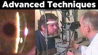 Slit Lamp Specular Reflection  Retroillumination  Sclerotic Scatter and more Advanced Techniques [upl. by Carilyn]