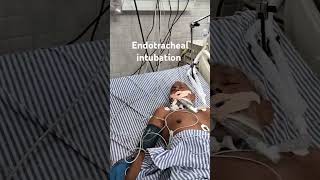 ENDOTRACHEAL INTUBATION  EMERGENCY PROCEDURES [upl. by Adnauqal]