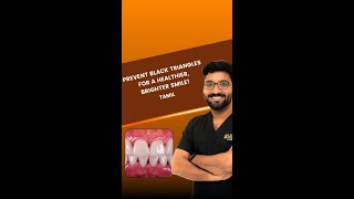 PREVENT BLACK TRIANGLES FOR A HEALTHIER BRIGHTER SMILE  Dr Diipkumar [upl. by Edythe552]