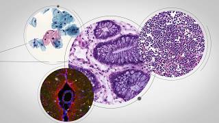 OptraSCAN OnDemand Digital Pathology Introduction [upl. by Enra]