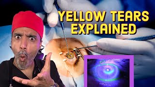 YELLOW TEAR TikTok Explained by a doctor [upl. by Bergstrom733]