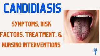 CANDIDIASIS SYMPTOMS Risk Factors Treatment amp Nursing Care [upl. by Nohs975]