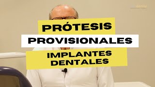 La importancia de los provisionales para los implantes dentales [upl. by Hannahsohs]