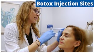 Botox Frontalis Glabella amp Nefertiti Treatment  Botox Injection Sites [upl. by Petigny]