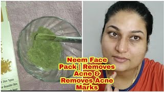 DIY Neem powder Face Pack  Removes Acne amp Removes Acne Marks  For All Skin Types [upl. by Oliana]