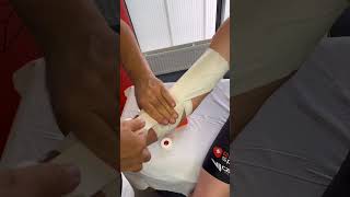 Spophy know how An elbow taping as prevention against overextension [upl. by Fisa]