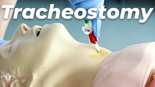 How to Perform a Tracheostomy [upl. by Dorin]