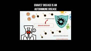 Graves disease is an autoimmune disease basedow gravesdisease autoimmunedisease thyroid [upl. by Dorsman]