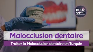 SOINS DENTAIRES  🦷Traiter la Malocclusion dentaire en Turquie  BODYEXPERT [upl. by Erena694]