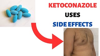 KETOCONAZOLE NIZORAL Uses Side effects Review Shampoo Cream Soap Lotion [upl. by Lubba]