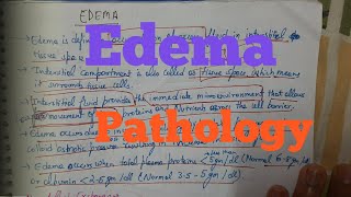 Edema Pathology [upl. by Liahkim254]