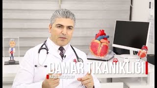 Kalp Damar Tıkanıklığı Nasıl Anlaşılır EKG EKO Efor Testi Kalp Sintigrafisi Anjiyo [upl. by Gagliano]