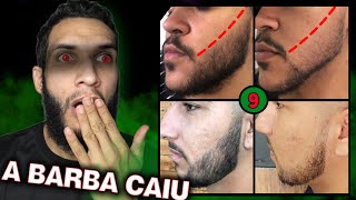 EVOLUÇÕES NEGATIVAS COM MINOXIDIL 9 [upl. by Llyrad194]