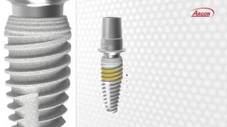 Argon Rapid amp Sure Implant Features amp Benefits Video [upl. by Bobby81]