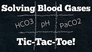 Acid Base Arterial Blood Gas ABG Interpretation Made Easy w TicTacToe Quick amp EZ Episode 13 [upl. by Chard]