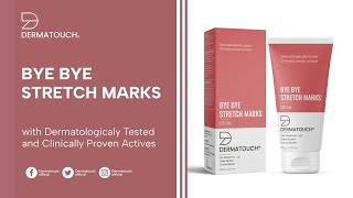 Stretch Mark Removal Cream  Dermatouch Bye Bye Stretch Marks Cream  Insights by Dr Sarin [upl. by Tnek]