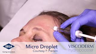 Viscoderm Hydrobooster  Microdroplet Technique Forehead Area [upl. by Sousa]