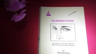 Vascular Blemishes Removal Telangiectases [upl. by Iatnwahs74]