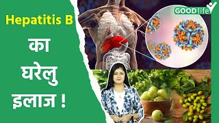 Hepatitis B Ka Gharelu Ilaj Symptoms Treatment In Hindi Goodlife [upl. by Ramaj]