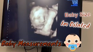 36 WEEKS GROWTH SCAN ULTRASOUND [upl. by Yecak]