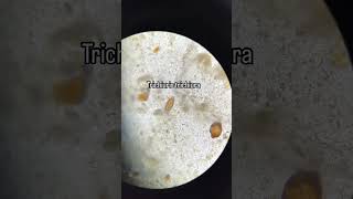 Trichuris trichiura biología science musica [upl. by Critchfield420]