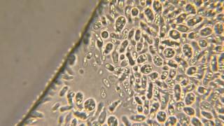 Yeast cells [upl. by Keli]