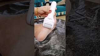 Feet Dirt amp Dead Skin Removal GadgetMost Easy Pedicure shorts [upl. by Guildroy]