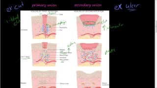 41Healing by First and Second Intention Wound Strength [upl. by Flavio]