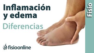 Inflamación y edema  Diferencias y características [upl. by Ahsitram]