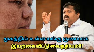 முகத்தில் உள்ள மங்கு கருமை நீங்கி பளபளப்பாக  DrSivaraman  Remedy for face darknessblack spots [upl. by Bartolemo]