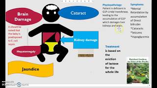 What is Galactosemia Causes Diagnosis Treatment Classic vs Galactokinase Deficiency USMLE NCLEX 3 M [upl. by Ebaj]