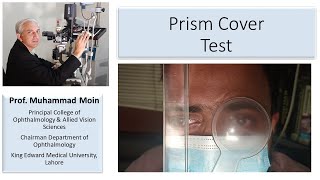 How to Perform Prism Cover Test [upl. by Adair]