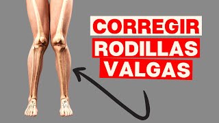 Como Corregir las RODILLAS VALGAS Piernas en X [upl. by Nahc]