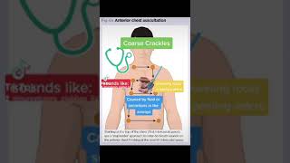 Chest Auscultation Identifying common BreathLung Sounds [upl. by Goldberg257]