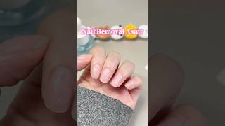 Satisfying Nail Removal Asmr [upl. by Nowaj523]