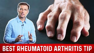 Best Tip For Rheumatoid Arthritis – Joint Pain Relief By DrBerg [upl. by Halihs]