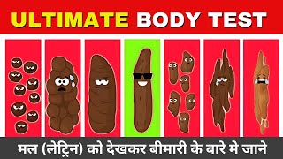 12 ज़रूरी बातें जो हमारा मल बताता है हमारी सेहत के बारे में  Things Stool Says About Your Health [upl. by Nileek]